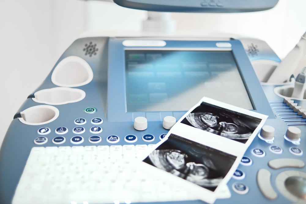 Guide to Ultrasound CPT Codes in Physical Therapy